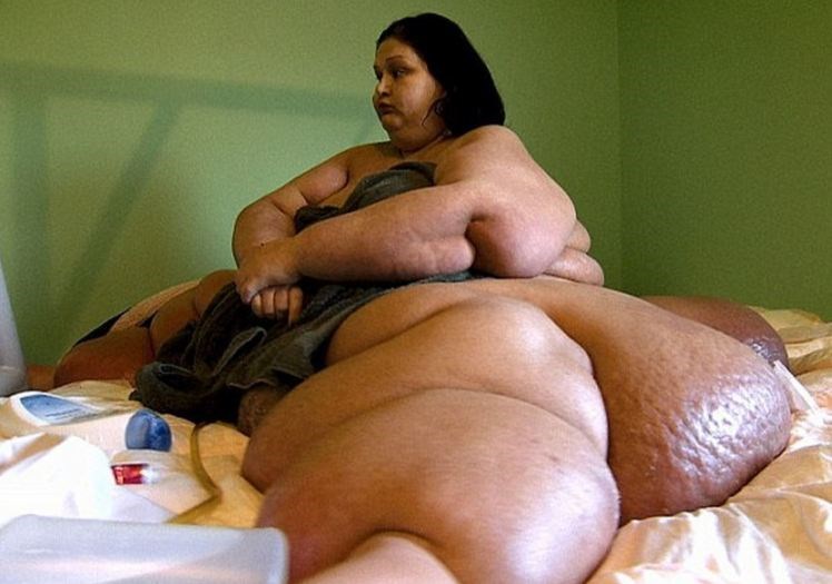 Mulher mais gorda do mundo perde 360 quilos e choca a todos 