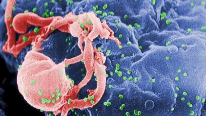 Cientistas conseguem uma "cura funcional" para o HIV