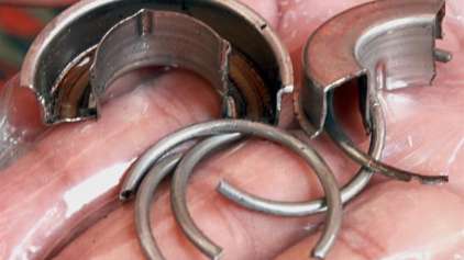 Homem fica 12 horas com partes intimas presa em um anel de aço 